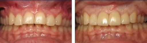 A recent cosmetic dental care job in the Huron, SD area