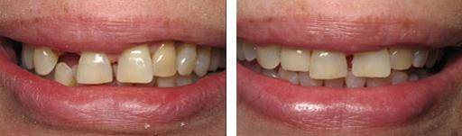 A recent implants dentist job in the Huron, SD area